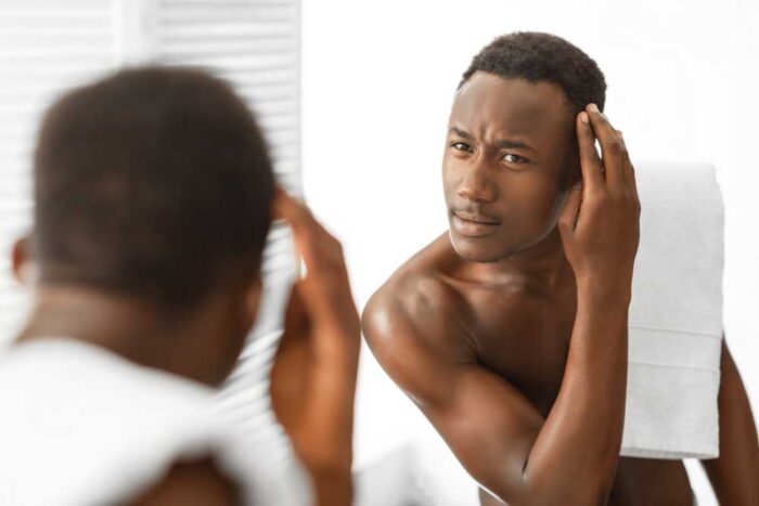Hair Loss Problems and Solutions for Men www.justlittlethings.co.uk